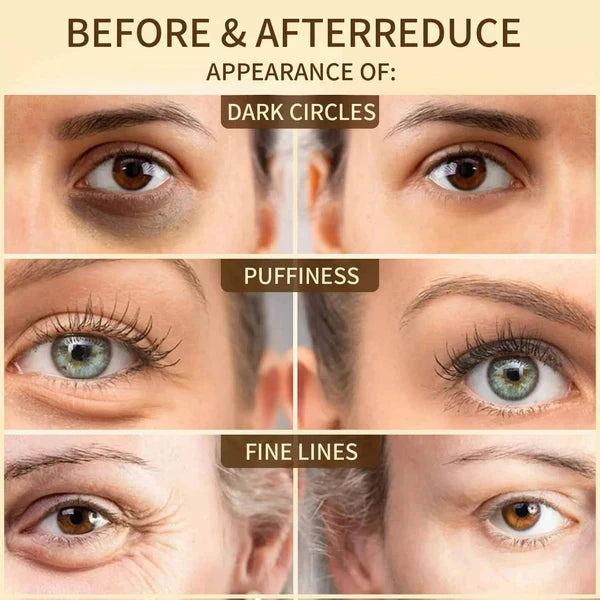 Beautyturess Milk Collagen Eye Masks (80g / 60 patches)