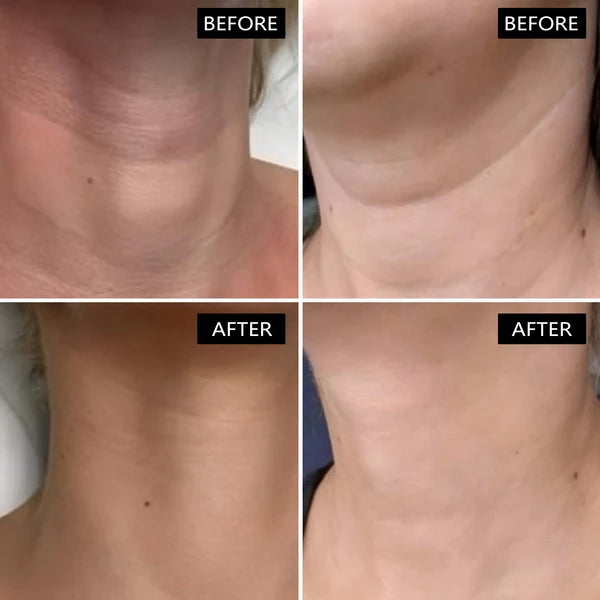 Beautyturess Neck Firming Cream (50ml)