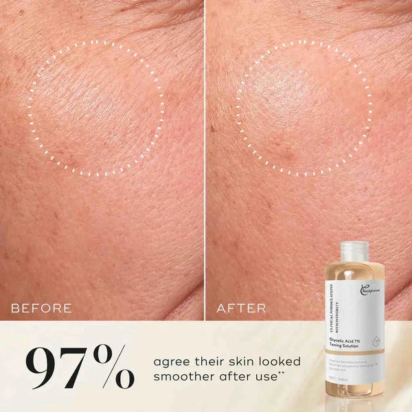Beautyturess Glikolacida Vizaĝtonigilo (AHA) – 240ml