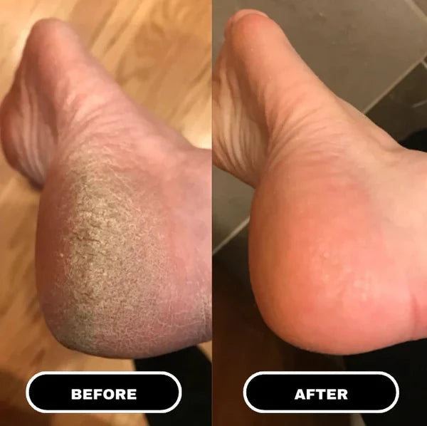 Beautyturess Niacinamide & Goat Milk Silky Moisturizing Foot Mask (50g * 1 pair)